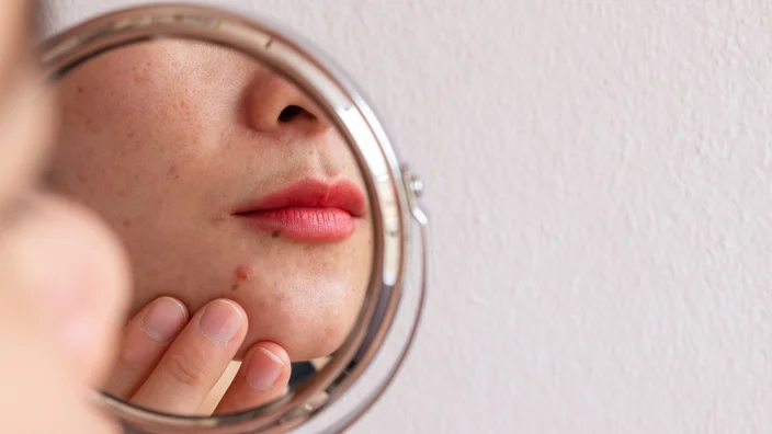 Price    VITAMINS FOR SKIN PROBLEMS      