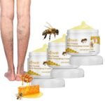 Varicose veins - Furzero Bienengift Krampfadern Crème