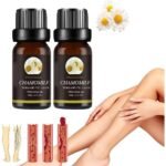 Varicose veins - Hiessgozy Marronie Öl für Krampfadern,  Fatigue - Hiessgozy Marronie Öl für Krampfadern