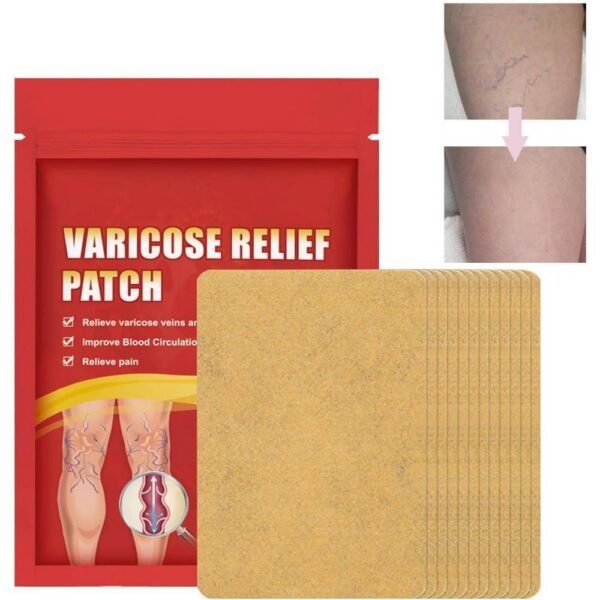 Varicose veins - Venenpflaster