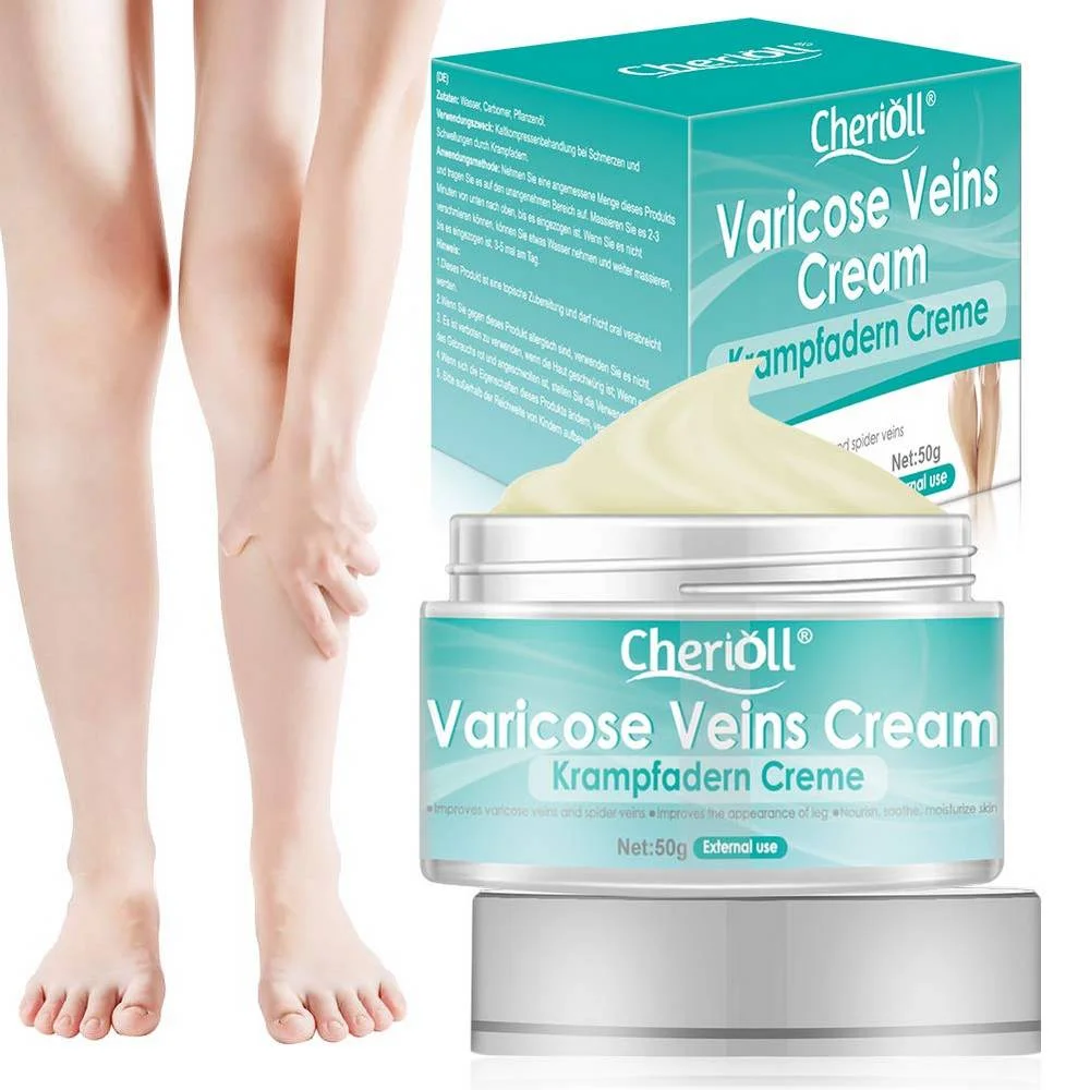 Varicose Veins Cream